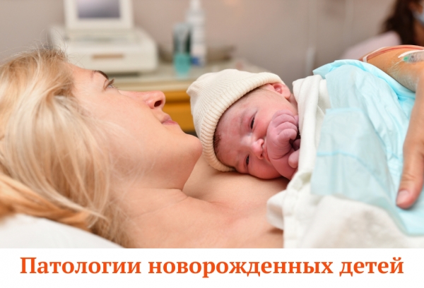 Новорожденный картинки